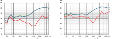 Comparaison des valeurs d'insonorisation